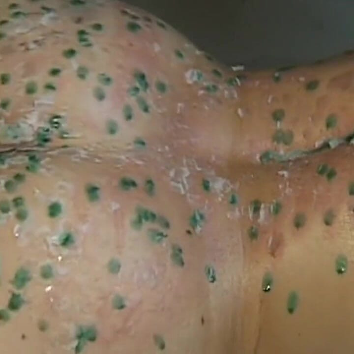 Mature MILF Enjoys Hot Wax Dripping Across Her Ass
