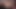 Eş orgazm komplikasyon ağrı hardsex