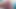 尿道挿入