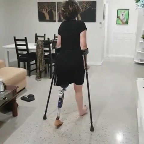 Amputee