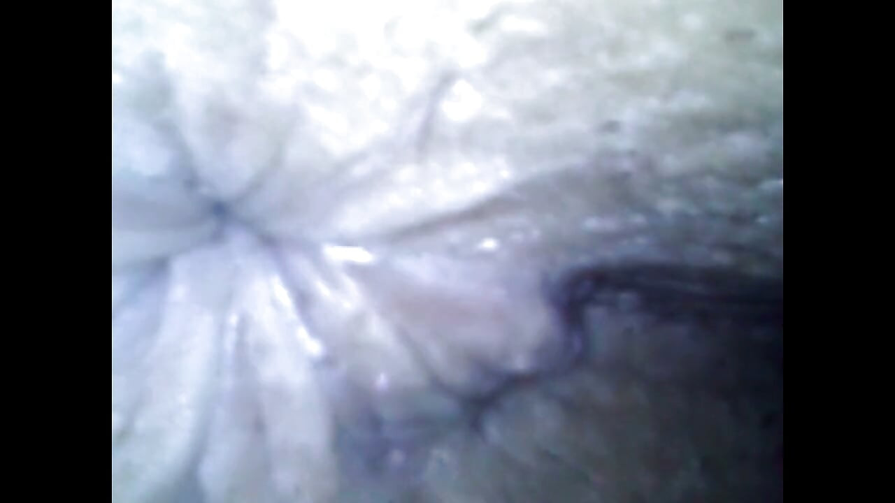Endoscope Details - Hole Balls Cock Foreskin Belly Nipples Mouth Sperm