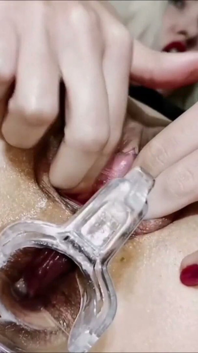 Huge opened ass hole close up to camera | Clip 1
