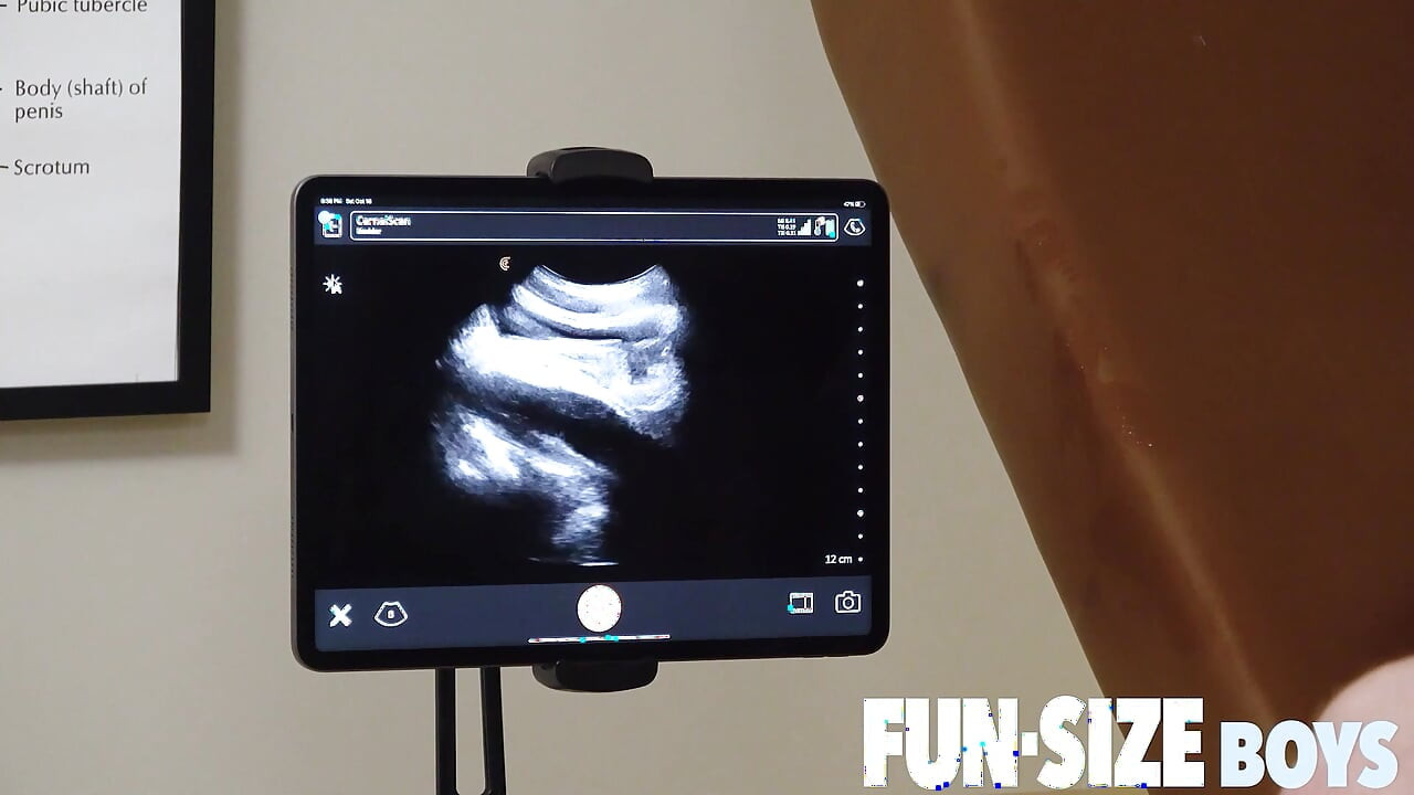 Funsizeboys - Dr Wolf สวีทเย็ดหนุ่มร่างบาง Tom Bennett ไม่ใส่ถุงยางบนอัลตร้าซาวนด์