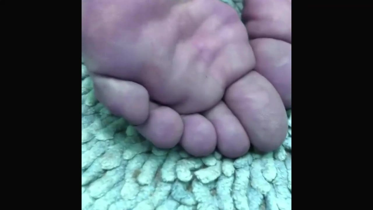 soles of the feet