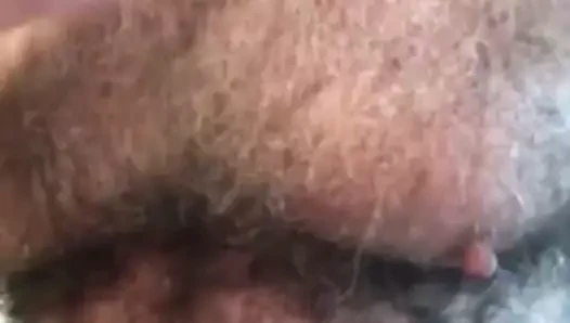 beyaz saç göğüs tarama