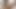 Lizzy Yum december 2023 clit teasing #1 Post Op Orgasm Pussy masturbation female edging