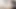 Одноногая девушка