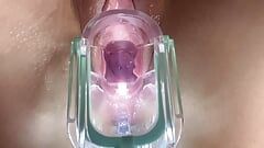Stella St. Rose - extrema escancarada, veja meu close-up do colo do útero usando um espéculo