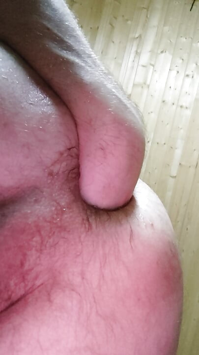 Anal Prolapse,Anal