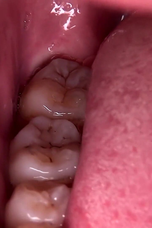 Teeth Examination - Beauty Unveiled