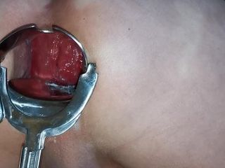Espéculo anal xo, escancarado meu cu