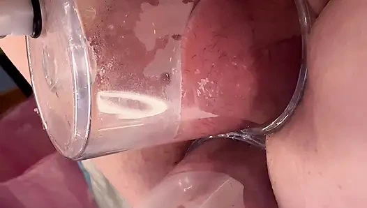 Çift Vakum Pompalama