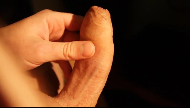 Foreskin pulling down