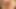 Lizzy Yum September 2023 different views #2 Post Op Orgasm Pussy Masturbation