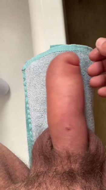 Stunning moment from "Saline Glucose Infusion Timelapse"