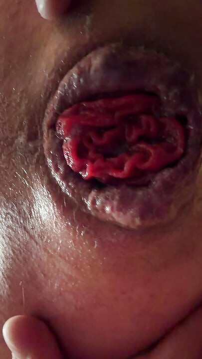 Sloppy hole