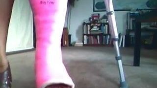 cast fetish - broken ankle