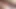 My STEPMOM'S ANAL HAS BEEN TORN UP, IT NEEDS TO BE TREATED. BIG HAIRY ANAL IS SICK. WE TREAT THE ANUS. Stepmom SWEARS AND MOANS