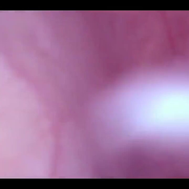 性交在我的阴户里，相机在我的膀胱里，疯狂的隆起！