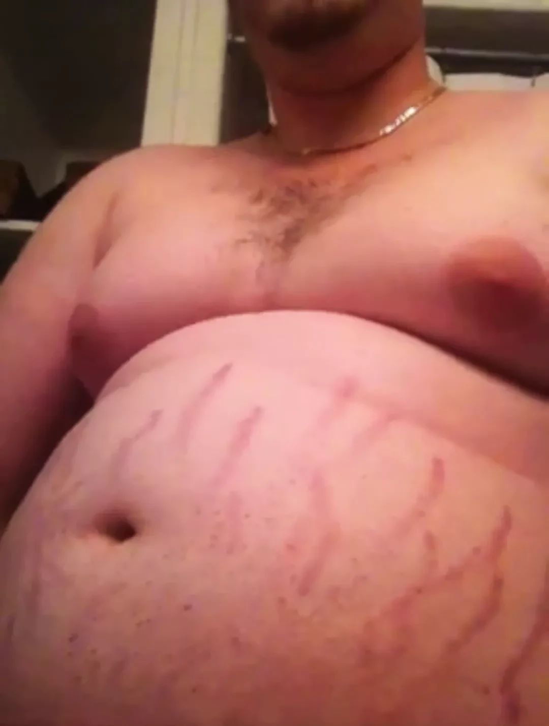 丰满的腹部抽搐脂肪妊娠纹