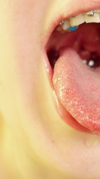 Spectacular moment from "braces mouth tour video - vore fetish"