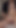 Spectacular moment from "A young sexy guy jerks off his penis in a condom and cums loudly, filling the condom with his sperm."