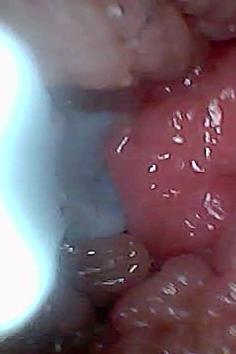 Visuele gids voor G-spot stimulatie en orgasme endoscoop perspectief