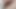 Mature hairy lady gyno checkup