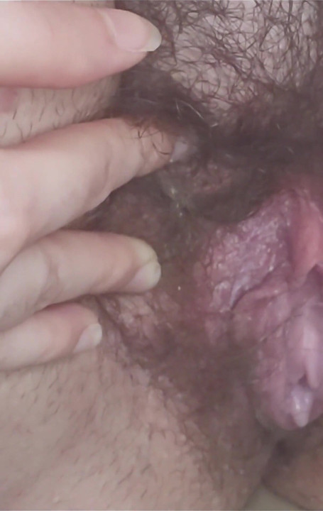 My Super Dirty, Smegma-filled Pussy