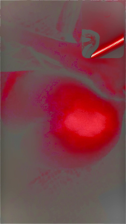 Penetraatio