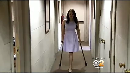Anna - RHP Amputee on Crutches