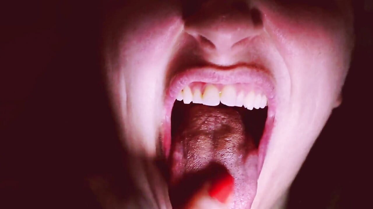 Preparing for Invisible Aligners