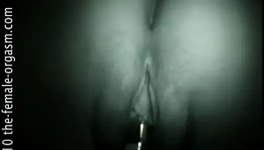 T Kelebek Altları Yukarı