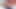 VRB Trans Redhead Goddess Is A Very Horny Patient VR Porn