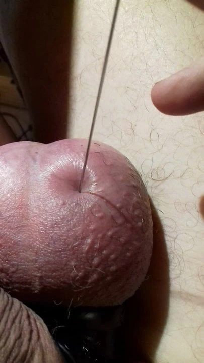 Agulha no testículo