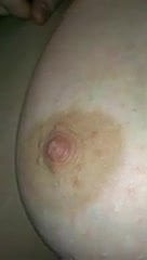 Nipple