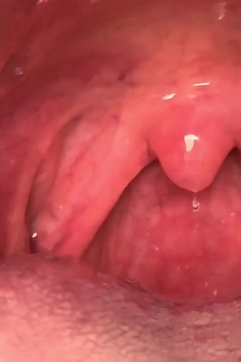 Uvula Fetish