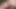 Sünnet derisi precum emiyor