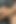 Masturbation