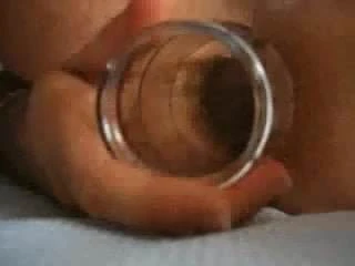 Anus et verine