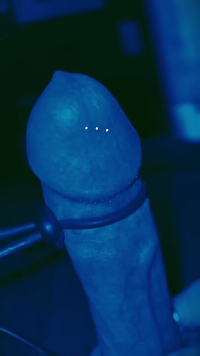 Estim (Dork-Edition)