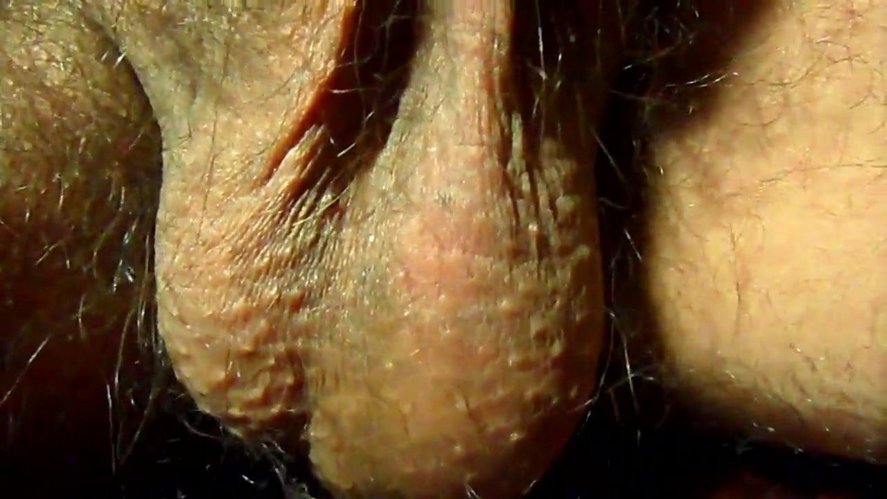Hairy Balls