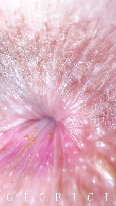 I asked my stepfather for permission to fart in his face because I really wanted to | Clip 1