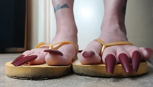 Toenails hanging off yellow flip flops