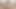 Lizzy Yum July 2023 Just Gas Me Post-op Orgasm Pussy Clit Masturbation Teasing Orgasm