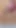 Camera Deep Inside Tight Pussy Captures Huge Cum Explosion
