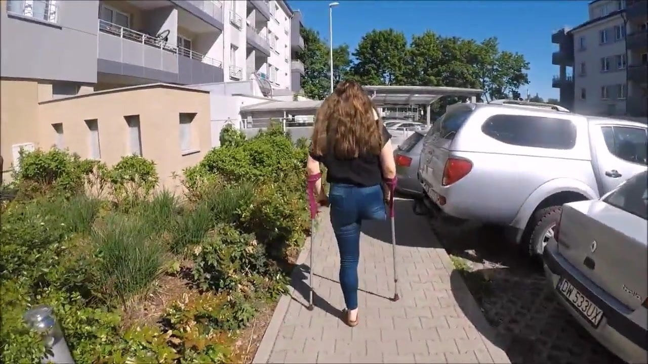 Amputee