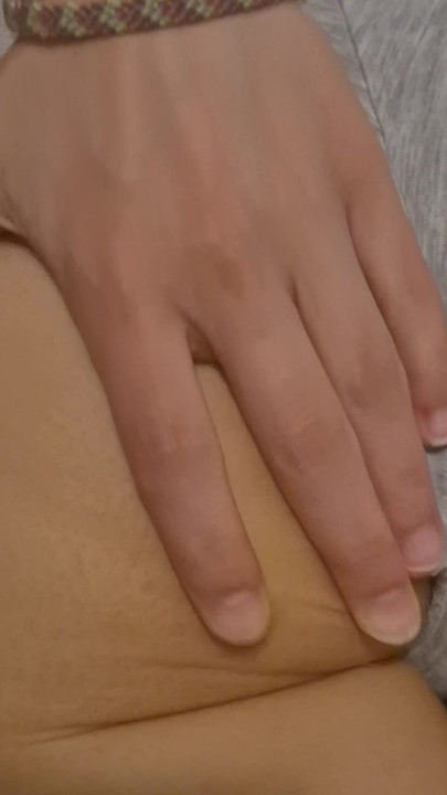 Always those annoying mosquito bites