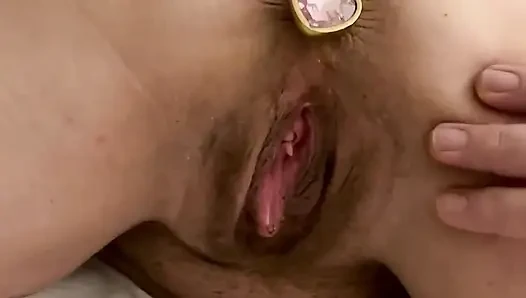 Marie göt tıkacı