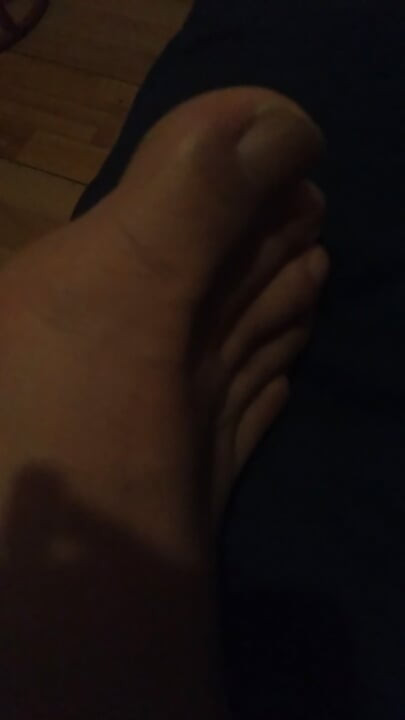 Moja crvena stopala